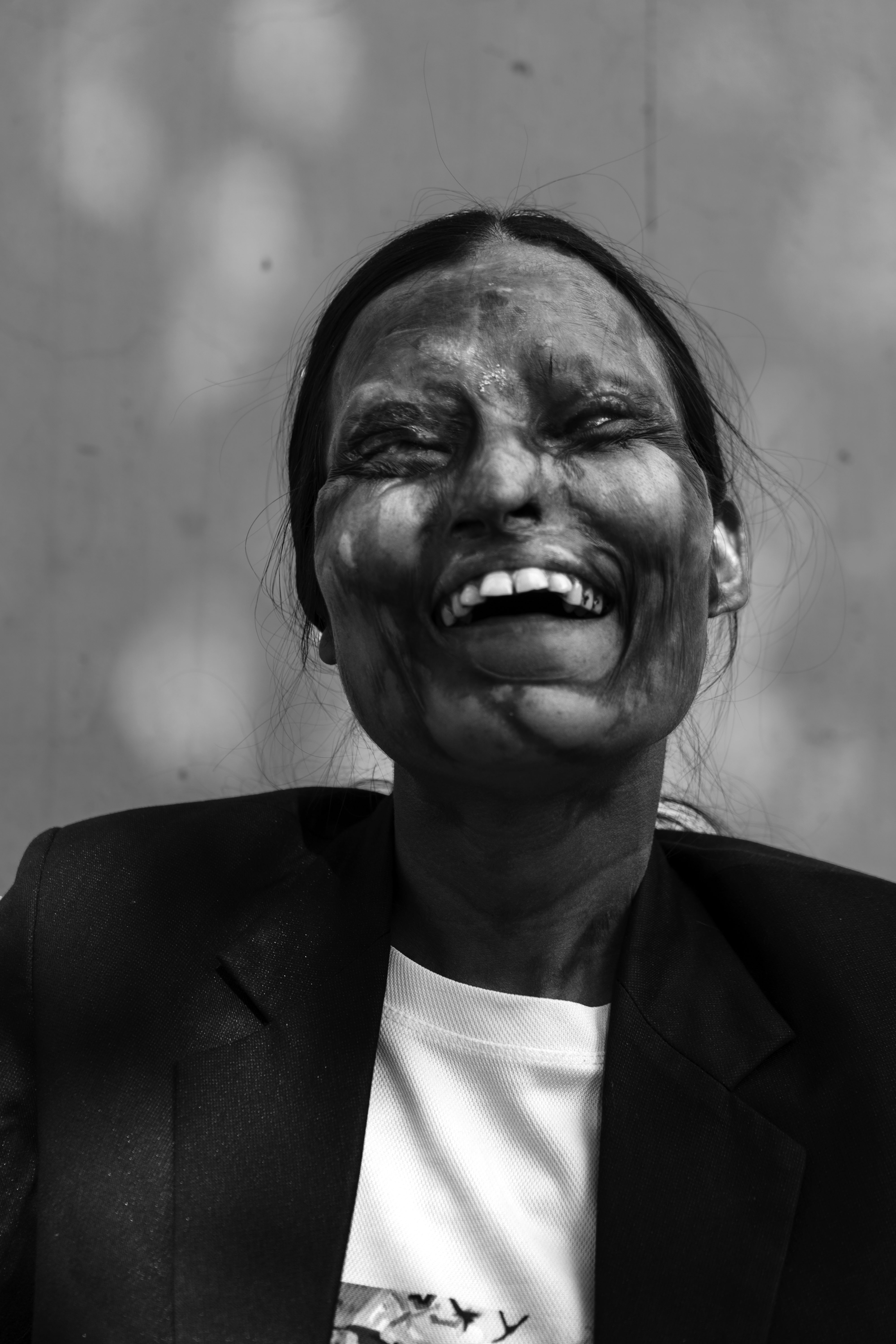 This-Indian-Cafe-is-Run-by-Acid-Attack-Survivors